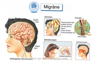 Zāļu izraisītas galvassāpes (sāpju mazinošas galvassāpes)