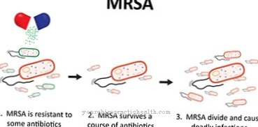 Slimības - MRSA infekcija