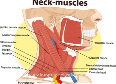 Torticollis mięśniowy (kręcz szyi)