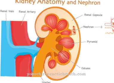Renal artery calcification (renal artery stenosis)