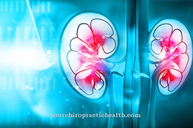 Kidney damage from drugs