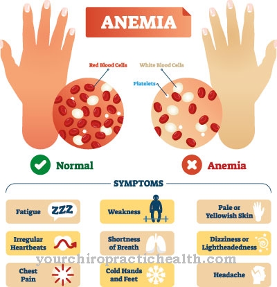 Vahingollinen anemia