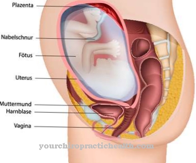 Placental insufficiency