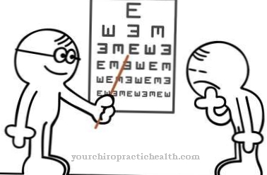 Presbyopia (presbyopia)