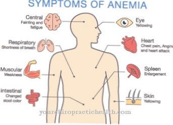 Anemia renal