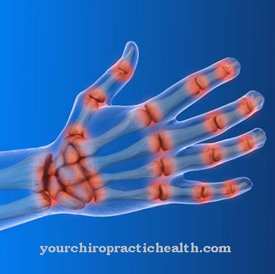 cum și cum să tratezi articulațiile pe mâini unguent articular indometacin