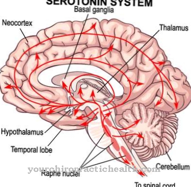 Serotonīna sindroms