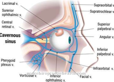 Cavernous Sinus Syndrome