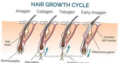 Silné vlasy (hirsutizmus)