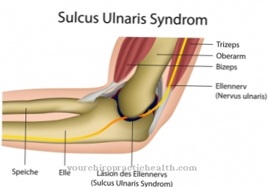 Ulnar Channel Syndrome