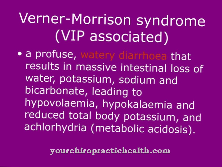 Hội chứng Verner-Morrison