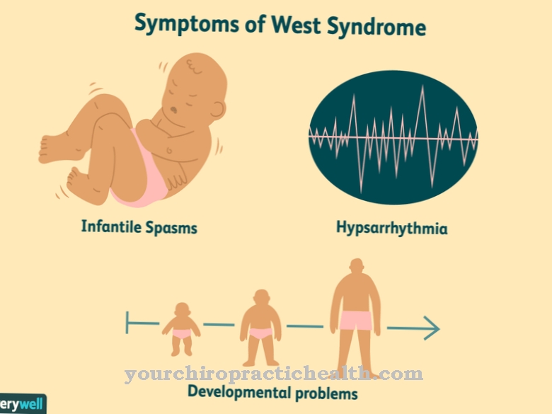 West Syndrome