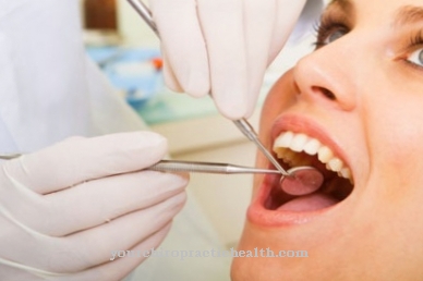 Tooth granulomas
