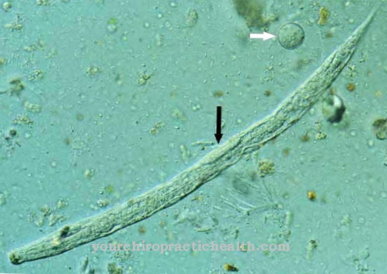 Infezione da nematodi nani