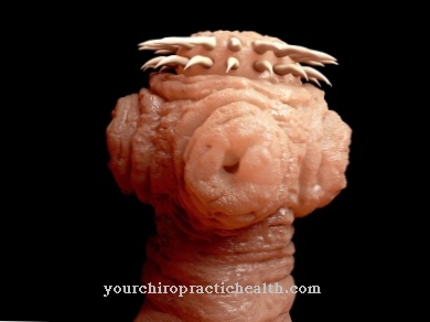 Pork tapeworm