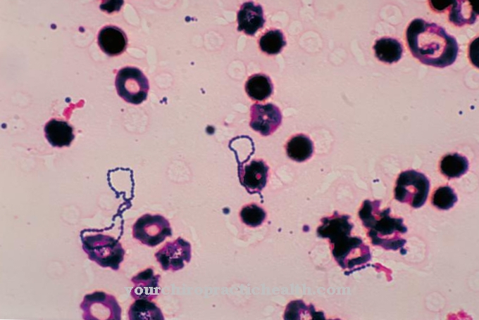 Streptococcus viridans (Viridans στρεπτόκοκκοι)