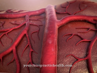 arteriogenese