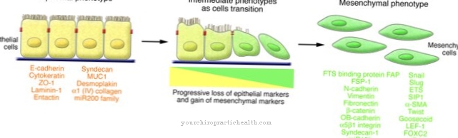 Epithelial-mesenchymal transition