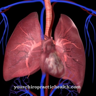 Rintangan vaskular paru