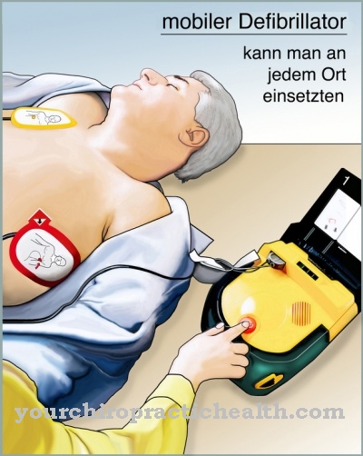 Defibrillaator