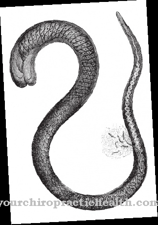 Trichinae in whipworm