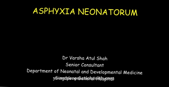 Asfixia neonatorum