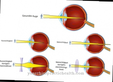 Eye diseases - when the eyes suffer