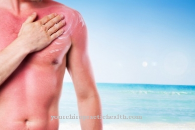 Summer heat - tips for proper sunbathing