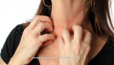 Eruzione cutanea sul collo