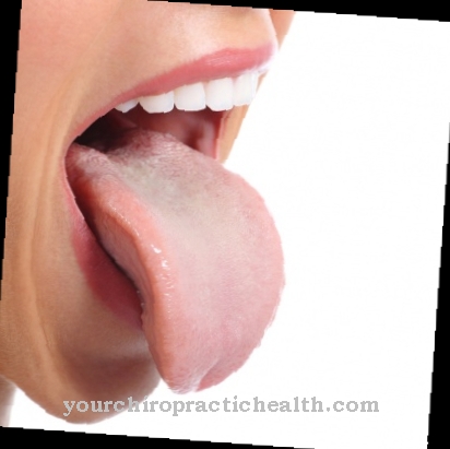 Blisters on the tongue