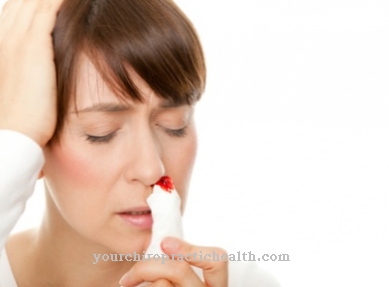 Kronične krvavitve iz nosu