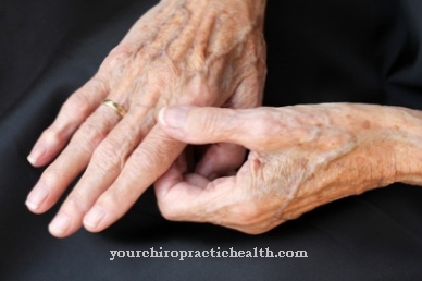 liječenje artroza i meda u vodi bol u gležnju i palcu