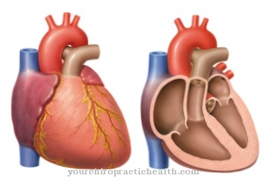 Καρδιομεγαλία