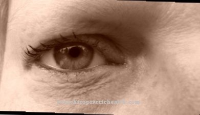 Nystagmus (eye tremors)