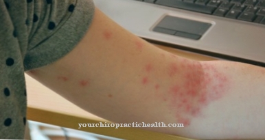 Red spots on the skin