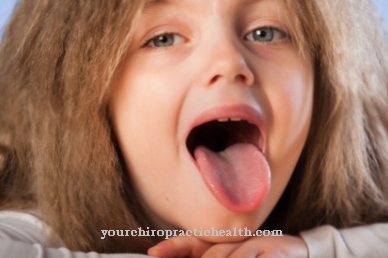 Tongue swelling
